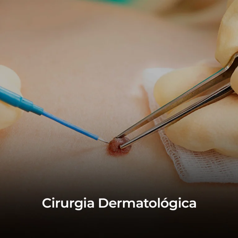 Cirurgia-Dermatológica copiar
