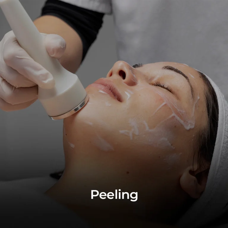 Peeling copiar