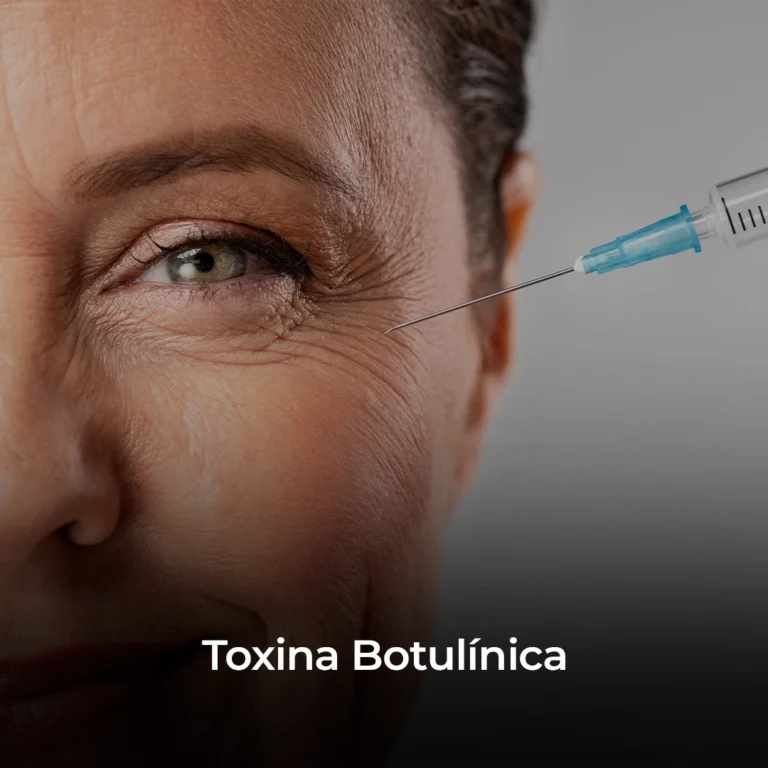 Toxina-Botulínica copiar